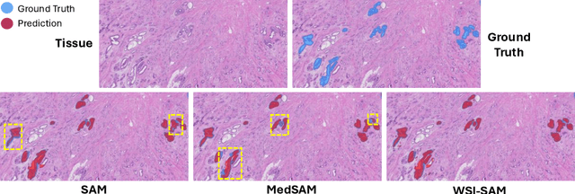 Figure 4 for WSI-SAM: Multi-resolution Segment Anything Model (SAM) for histopathology whole-slide images