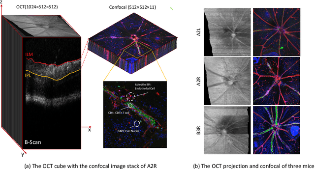 Figure 3 for The Quest for Early Detection of Retinal Disease: 3D CycleGAN-based Translation of Optical Coherence Tomography into Confocal Microscopy