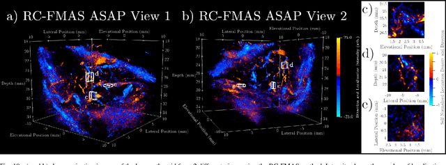 Figure 2 for Ultrafast 3-D Super Resolution Ultrasound using Row-Column Array specific Coherence-based Beamforming and Rolling Acoustic Sub-aperture Processing: In Vitro, In Vivo and Clinical Study