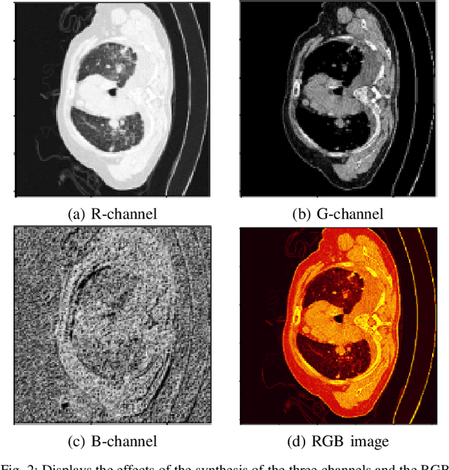 Figure 2 for Intensity-Spatial Dual Masked Autoencoder for Multi-Scale Feature Learning in Chest CT Segmentation