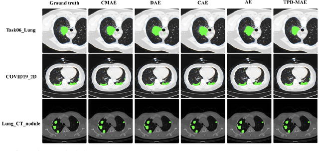 Figure 4 for Intensity-Spatial Dual Masked Autoencoder for Multi-Scale Feature Learning in Chest CT Segmentation