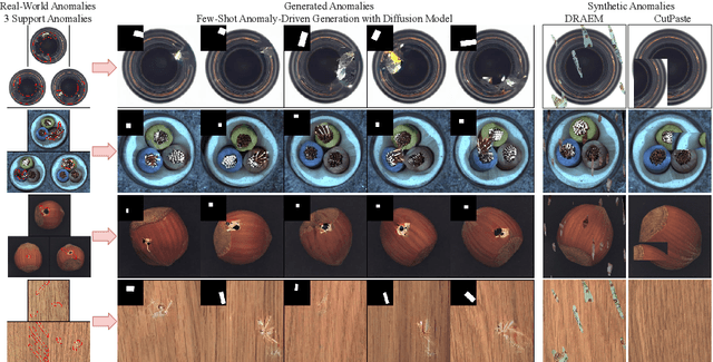 Figure 1 for Few-Shot Anomaly-Driven Generation for Anomaly Classification and Segmentation