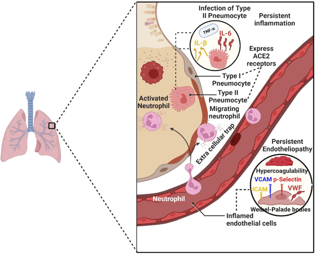 Figure 3 for COVID-19: post infection implications in different age groups, mechanism, diagnosis, effective prevention, treatment, and recommendations