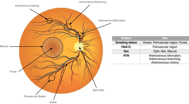 Figure 3 for Artificial Intelligence in Assessing Cardiovascular Diseases and Risk Factors via Retinal Fundus Images: A Review of the Last Decade