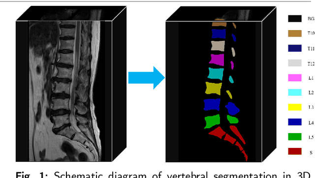 Figure 1 for SpineMamba: Enhancing 3D Spinal Segmentation in Clinical Imaging through Residual Visual Mamba Layers and Shape Priors