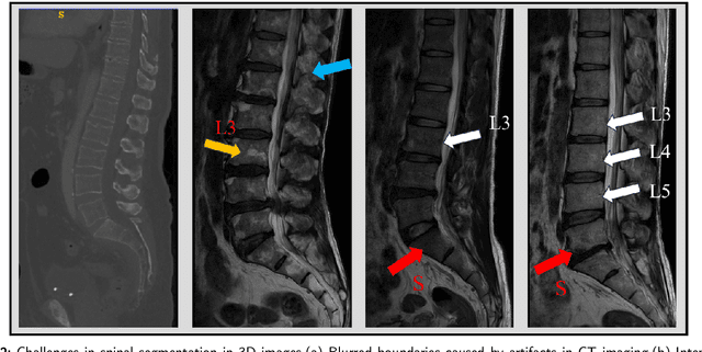 Figure 2 for SpineMamba: Enhancing 3D Spinal Segmentation in Clinical Imaging through Residual Visual Mamba Layers and Shape Priors