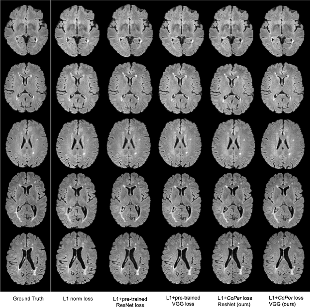 Figure 2 for A Domain-specific Perceptual Metric via Contrastive Self-supervised Representation: Applications on Natural and Medical Images
