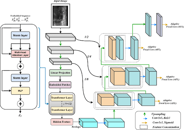 Figure 1 for Prostate Capsule Segmentation from Micro-Ultrasound Images using Adaptive Focal Loss