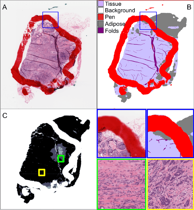 Figure 1 for Semantic Segmentation Based Quality Control of Histopathology Whole Slide Images