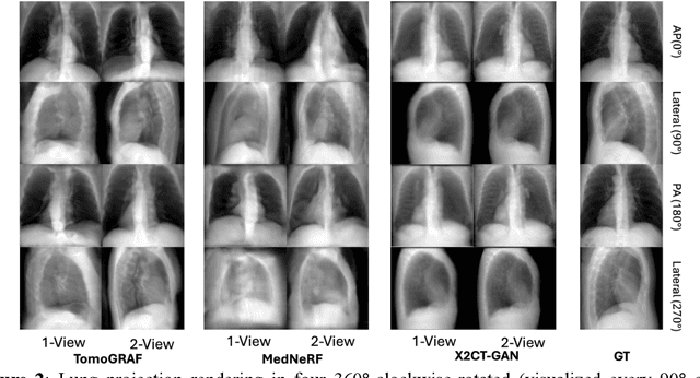 Figure 2 for TomoGRAF: A Robust and Generalizable Reconstruction Network for Single-View Computed Tomography