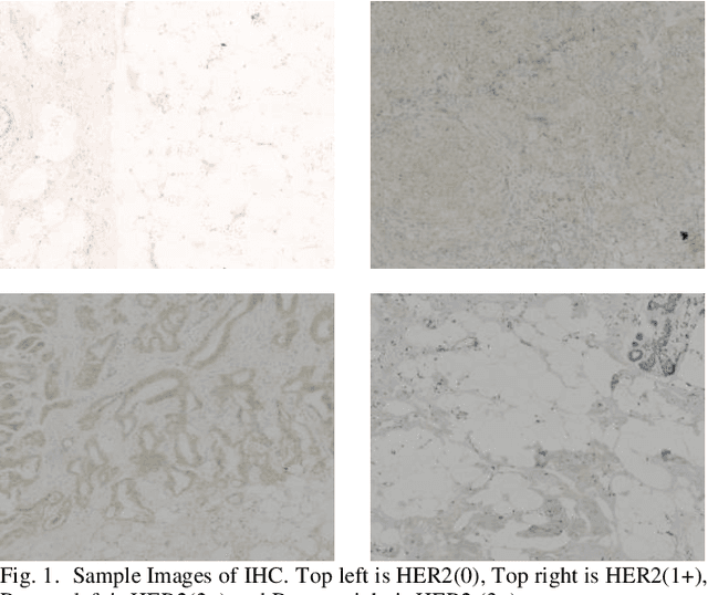 Figure 1 for convoHER2: A Deep Neural Network for Multi-Stage Classification of HER2 Breast Cancer