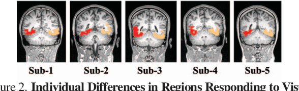 Figure 2 for Seeing Beyond the Brain: Conditional Diffusion Model with Sparse Masked Modeling for Vision Decoding