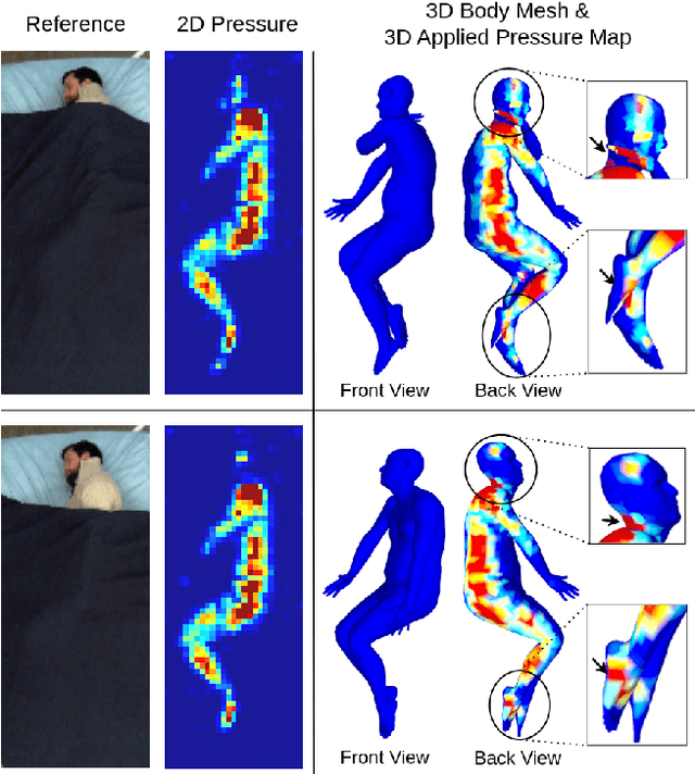 Figure 2 for BodyMAP -- Jointly Predicting Body Mesh and 3D Applied Pressure Map for People in Bed