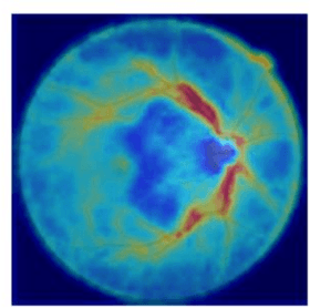 Figure 4 for Deep Learning with HM-VGG: AI Strategies for Multi-modal Image Analysis