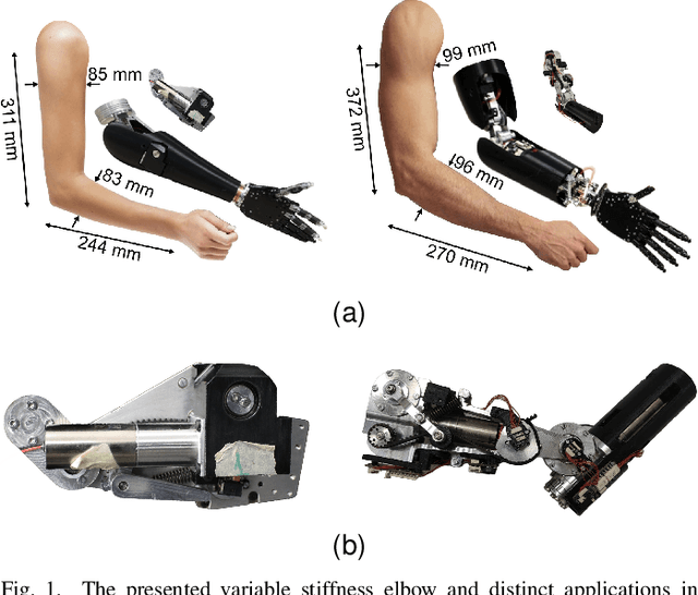 Figure 1 for Design, Characterization, and Validation of a Variable Stiffness Prosthetic Elbow