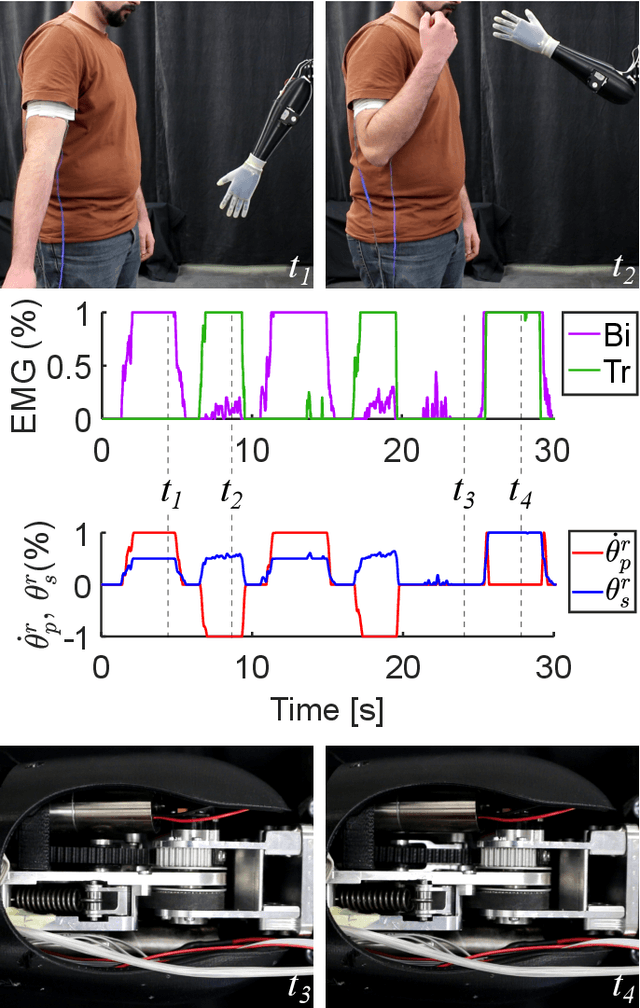 Figure 4 for Design, Characterization, and Validation of a Variable Stiffness Prosthetic Elbow