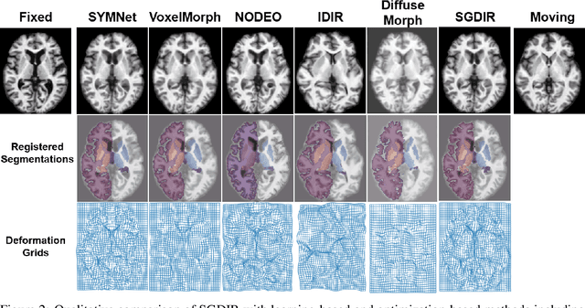 Figure 3 for Learning Diffeomorphism for Image Registration with Time-Continuous Networks using Semigroup Regularization