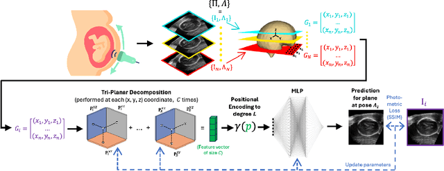Figure 3 for RapidVol: Rapid Reconstruction of 3D Ultrasound Volumes from Sensorless 2D Scans