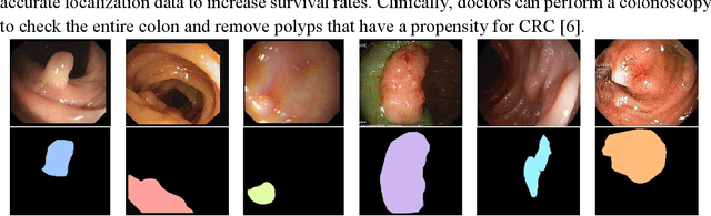 Figure 3 for Multi-scale and Multi-path Cascaded Convolutional Network for Semantic Segmentation of Colorectal Polyps