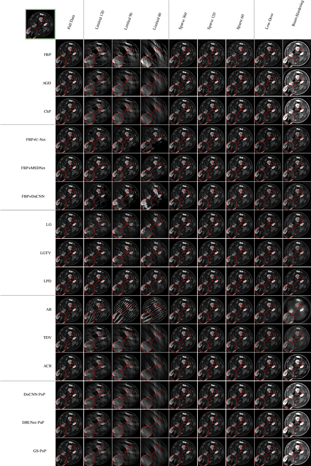 Figure 4 for Benchmarking learned algorithms for computed tomography image reconstruction tasks