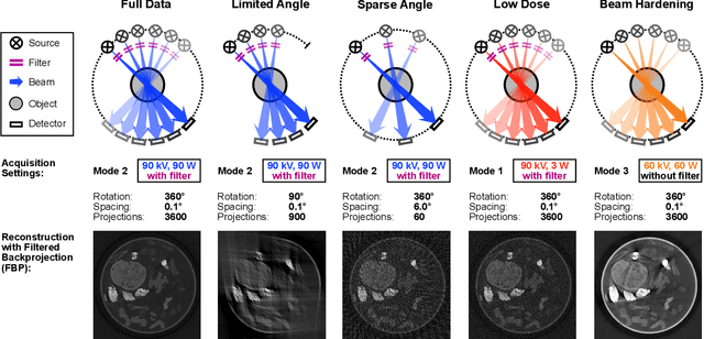 Figure 2 for Benchmarking learned algorithms for computed tomography image reconstruction tasks