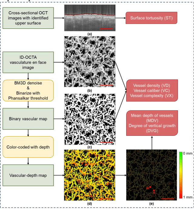 Figure 2 for Fine-grained Classification of Port Wine Stains Using Optical Coherence Tomography Angiography