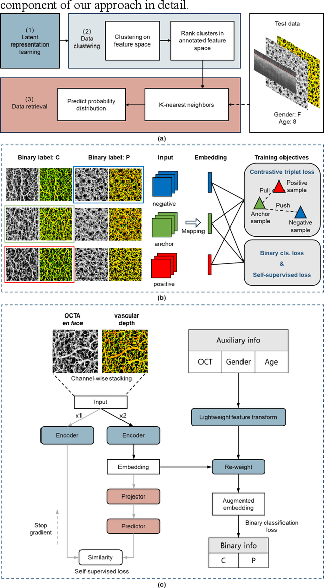 Figure 3 for Fine-grained Classification of Port Wine Stains Using Optical Coherence Tomography Angiography