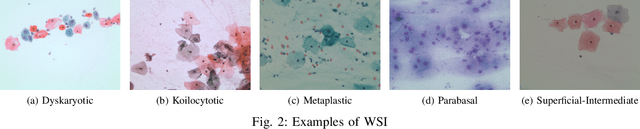 Figure 3 for Deep Learning Enabled Segmentation, Classification and Risk Assessment of Cervical Cancer