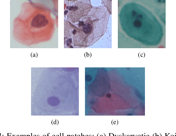 Figure 4 for Deep Learning Enabled Segmentation, Classification and Risk Assessment of Cervical Cancer