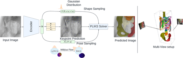 Figure 3 for ProPLIKS: Probablistic 3D human body pose estimation