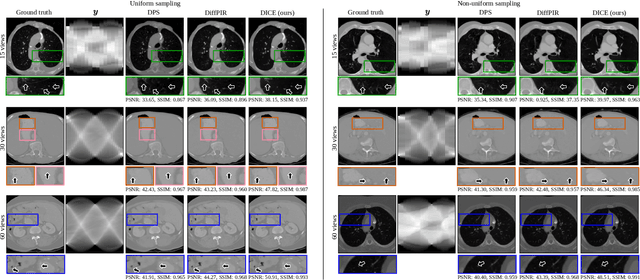Figure 1 for DICE: Diffusion Consensus Equilibrium for Sparse-view CT Reconstruction