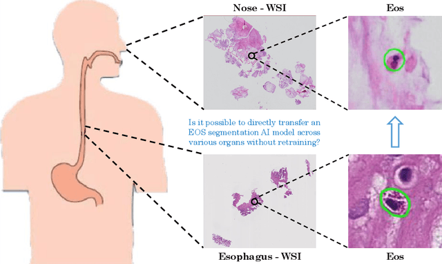 Figure 1 for Cross-organ Deployment of EOS Detection AI without Retraining: Feasibility and Limitation