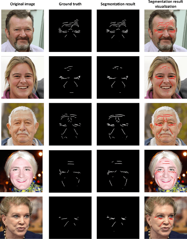 Figure 3 for Weakly Supervised Pretraining and Multi-Annotator Supervised Finetuning for Facial Wrinkle Detection