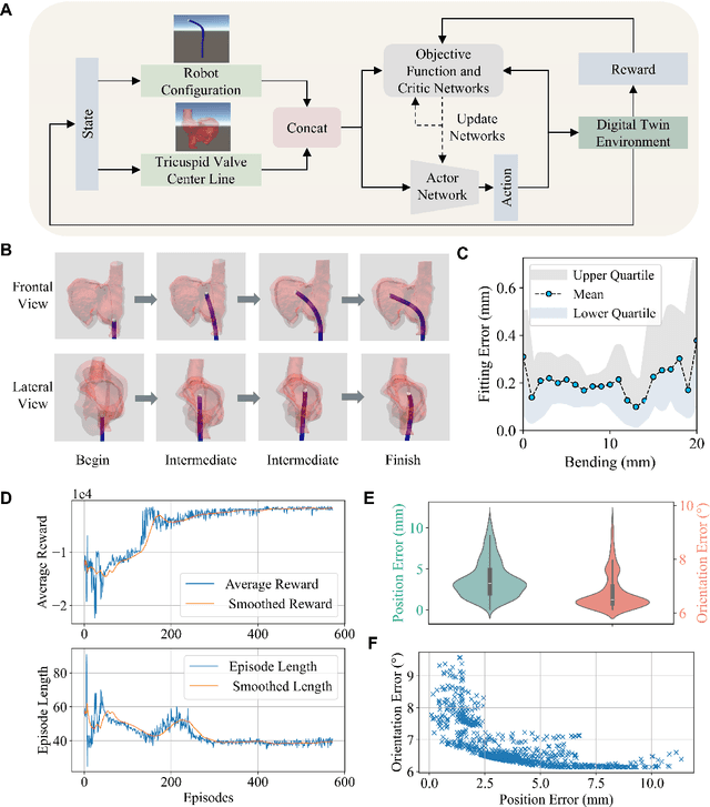 Figure 3 for Robotic transcatheter tricuspid valve replacement with hybrid enhanced intelligence: a new paradigm and first-in-vivo study