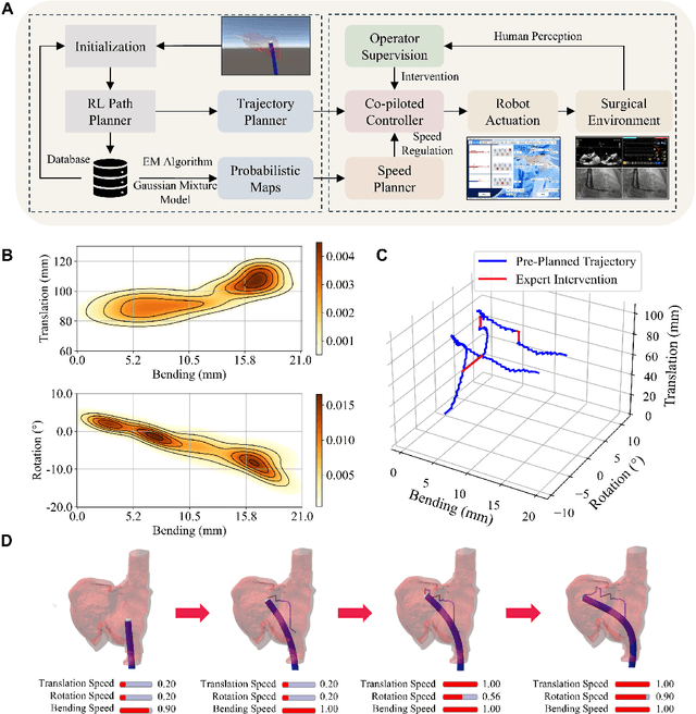 Figure 4 for Robotic transcatheter tricuspid valve replacement with hybrid enhanced intelligence: a new paradigm and first-in-vivo study