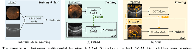 Figure 1 for MultiEYE: Dataset and Benchmark for OCT-Enhanced Retinal Disease Recognition from Fundus Images