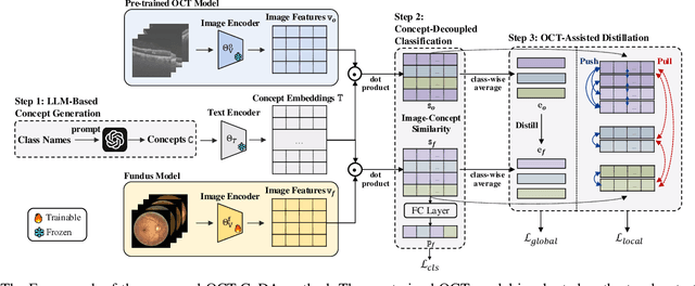 Figure 2 for MultiEYE: Dataset and Benchmark for OCT-Enhanced Retinal Disease Recognition from Fundus Images