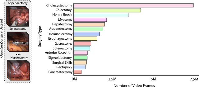 Figure 4 for General surgery vision transformer: A video pre-trained foundation model for general surgery