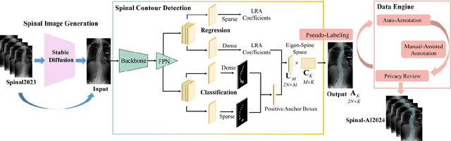 Figure 2 for SG-LRA: Self-Generating Automatic Scoliosis Cobb Angle Measurement with Low-Rank Approximation