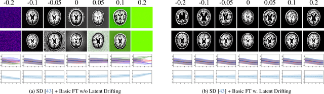 Figure 4 for Latent Drifting in Diffusion Models for Counterfactual Medical Image Synthesis