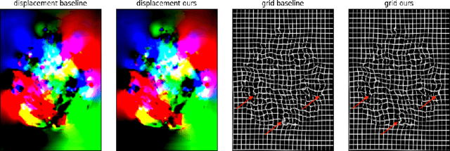 Figure 3 for Fine-Tuning TransMorph with Gradient Correlation for Anatomical Alignment