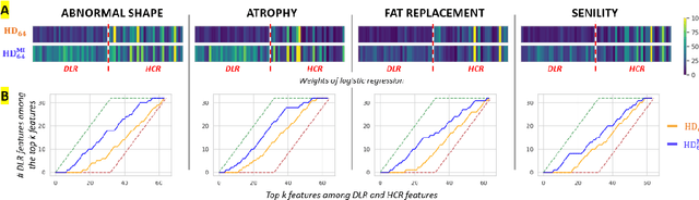 Figure 3 for Non-Redundant Combination of Hand-Crafted and Deep Learning Radiomics: Application to the Early Detection of Pancreatic Cancer