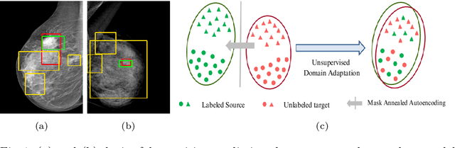 Figure 1 for D-MASTER: Mask Annealed Transformer for Unsupervised Domain Adaptation in Breast Cancer Detection from Mammograms