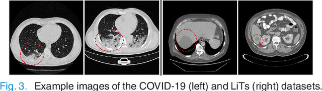 Figure 3 for A Self Supervised StyleGAN for Image Annotation and Classification with Extremely Limited Labels