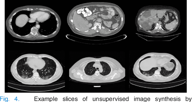 Figure 4 for A Self Supervised StyleGAN for Image Annotation and Classification with Extremely Limited Labels