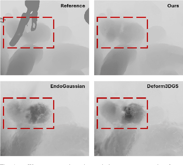 Figure 1 for SurgicalGS: Dynamic 3D Gaussian Splatting for Accurate Robotic-Assisted Surgical Scene Reconstruction