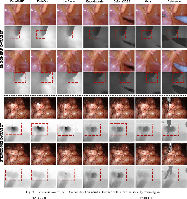 Figure 3 for SurgicalGS: Dynamic 3D Gaussian Splatting for Accurate Robotic-Assisted Surgical Scene Reconstruction