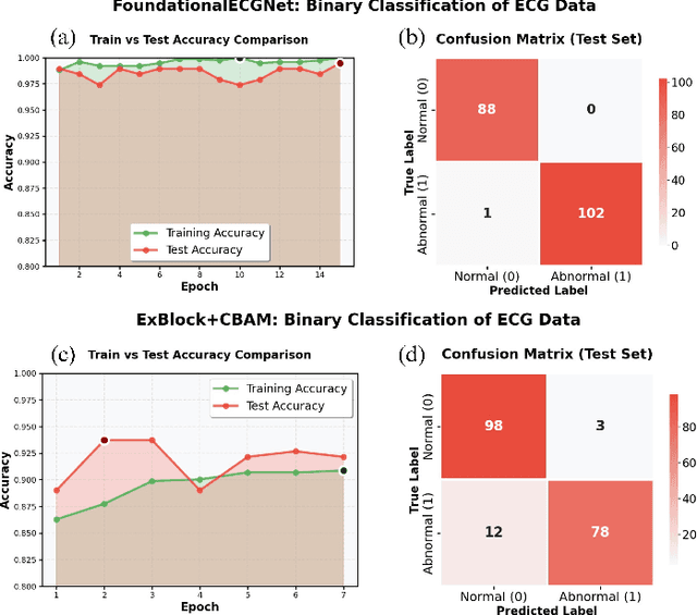 Figure 2 for FoundationalECGNet: A Lightweight Foundational Model for ECG-based Multitask Cardiac Analysis