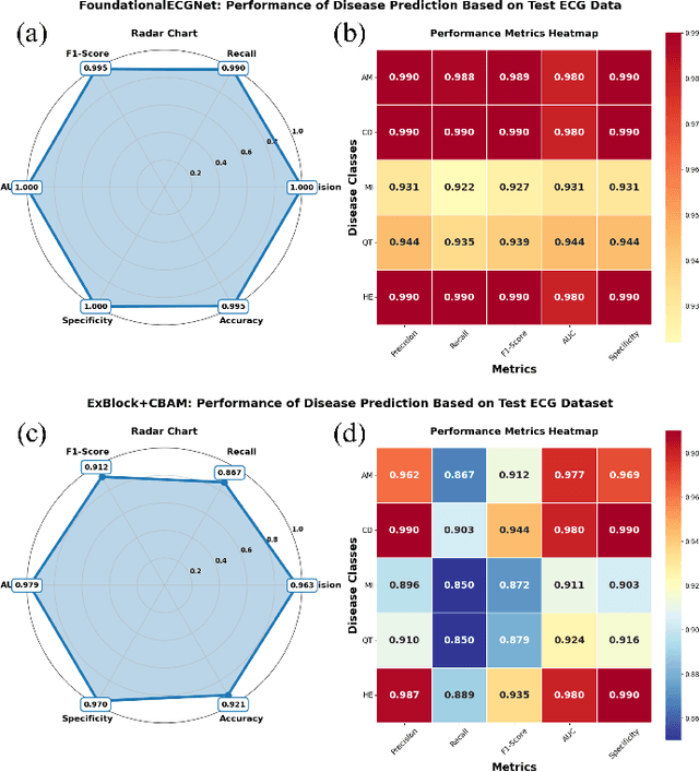 Figure 3 for FoundationalECGNet: A Lightweight Foundational Model for ECG-based Multitask Cardiac Analysis