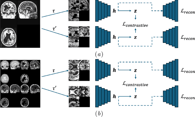 Figure 1 for Unified 3D MRI Representations via Sequence-Invariant Contrastive Learning